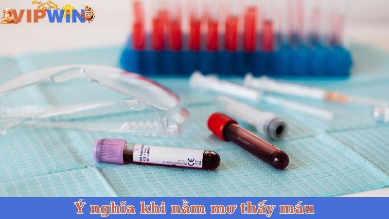 Ý nghĩa khi nằm mơ thấy máu